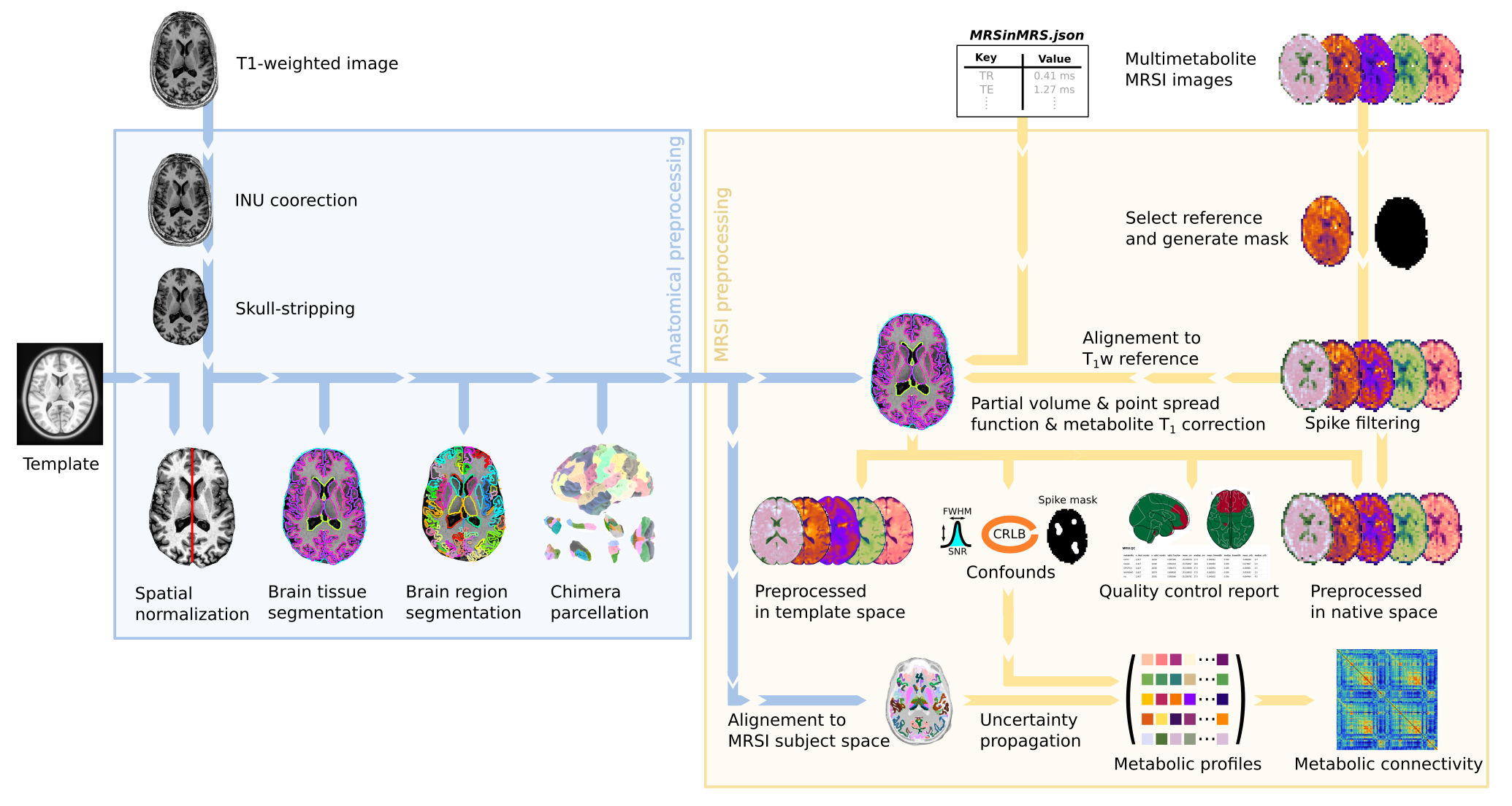 MRSIPrep pipeline schematic