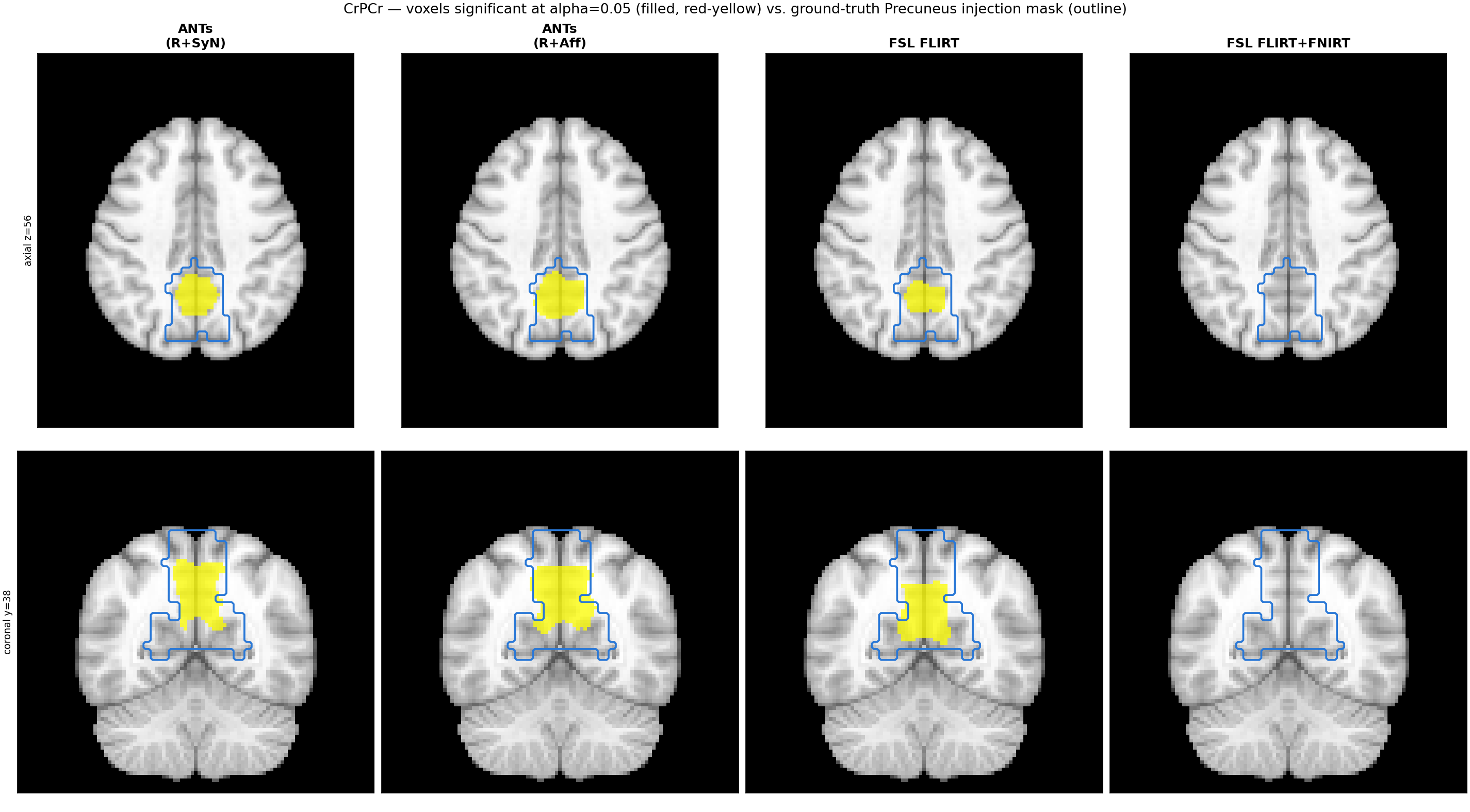 CrPCr: voxels significant at alpha=0.05 (filled) vs. ground-truth Precuneus injection mask (outline), for ANTs (R+SyN), ANTs (R+Aff), FSL FLIRT, and FSL FLIRT+FNIRT