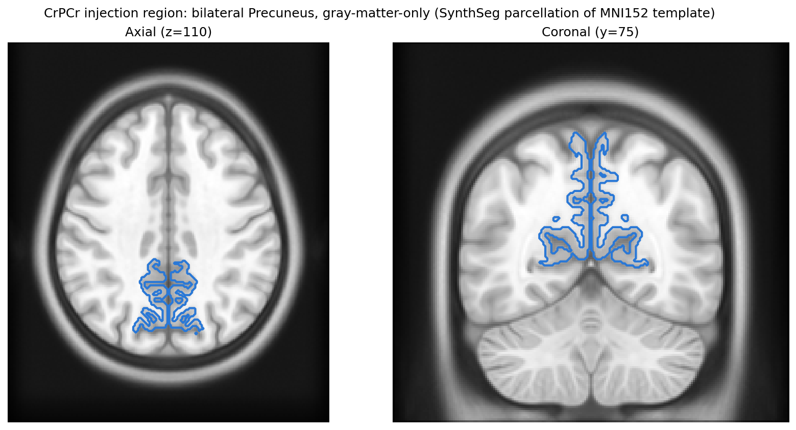 CrPCr injection region: bilateral Precuneus, gray-matter-only, from a SynthSeg parcellation of the MNI152 template itself