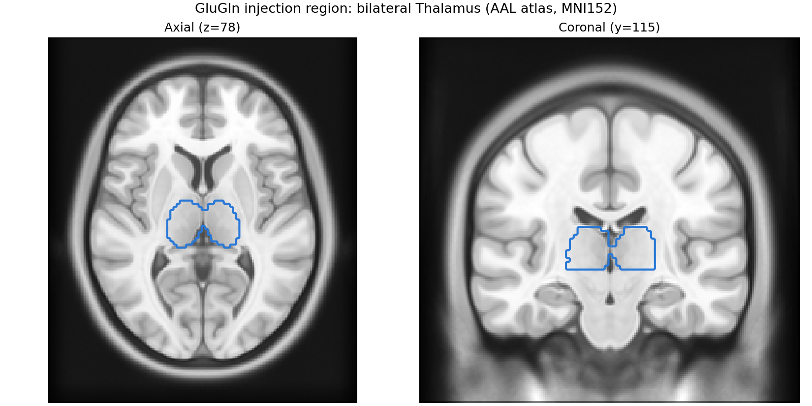 GluGln injection region, bilateral Thalamus outlined on the MNI152 template from a real AAL atlas parcellation, axial and coronal slices